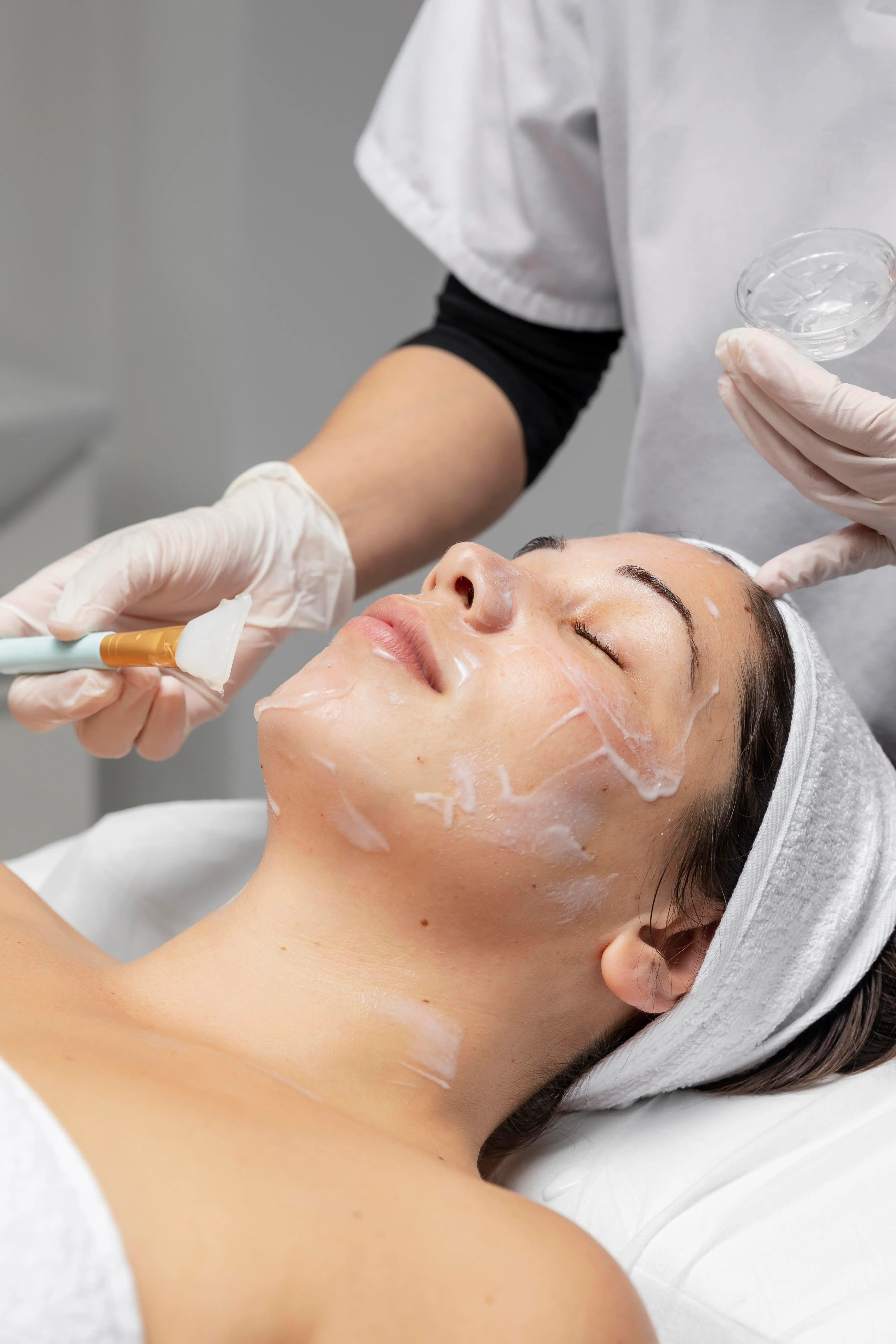 Skin Peels